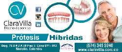 Protesis Hibridas, Protesis Dentales, Protesis Metal Re Medellin, Colombia