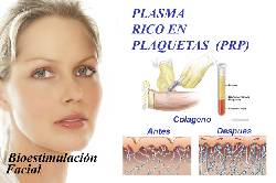 plasma rico en plaquetas medellin, colombia