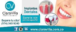 Implantes dentales en Medellin - tratamiento con implan Medellin, Colombia