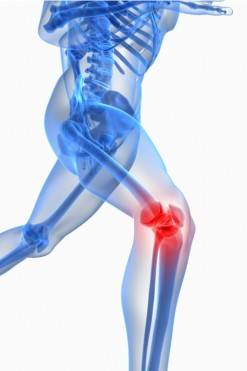Clinica de artrosis y osteoporosis Bogot D.C., Colombia