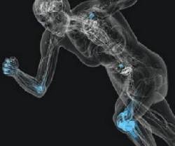 Dolor, inflamacin imposibilidad para bajar escaleras Bogot D.C., Colombia