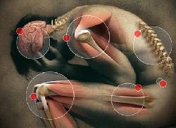 No quieres un reemplazo articular o artroplastia. Bogot D.C., Colombia