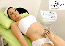 ULTRACAVITACI�N REDUCCI�N Y MOLDEAMIENTO EN MEDELLIN Medell�n, colombia