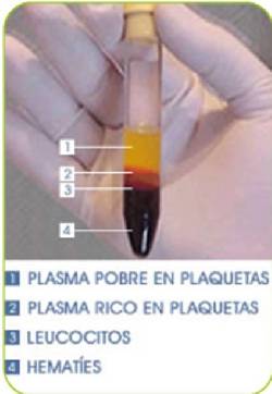 rejuvenecimiento facial con plasma bogota vasculaser bogota, colombia