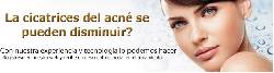 tratamiento del acne bogota unidad laser y piel bogota, colombia