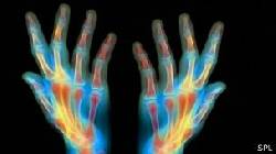 Consulta Particular Ortopedia y Traumatologia Bogota, Colombia