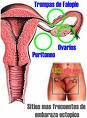 ANALISIS DE EMBARAZO CENTRO  FEMENINO- 793 8202 lima, peru