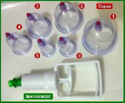 Vacumterapia de Alta Succin con set de 6 copas.  Bogota, Colombia