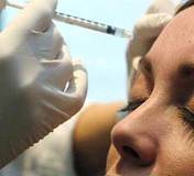 TRATAMIENTO FACIAL PLASMA RICO EN PLAQUETAS Bogota, COlombia