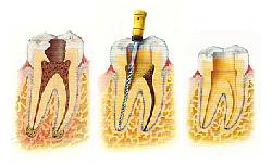 Ofresco Sevicios como Odontolgo endodoncista Barranquilla, Colombia