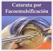 CIRUGIA DE CATARATA y GLAUCOMA CON TECNOLOGIA LASE Lima, Peru