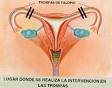 ANALISIS  .ATRASO MENSTRUAL  301 3212 lima, peru