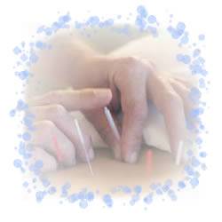 Acupuntura China - Medico Acupuntor bs as, Argentina