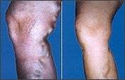 Cirugia de Obesidad, Hiperhidrosis, etc. en Lima, Lima, Peru