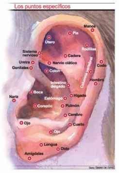 Auriculoterapia, caja de 100 balines +dieta+lamina bogota, colombia